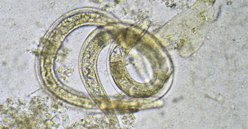 A closeup view of a threadworm parasite.